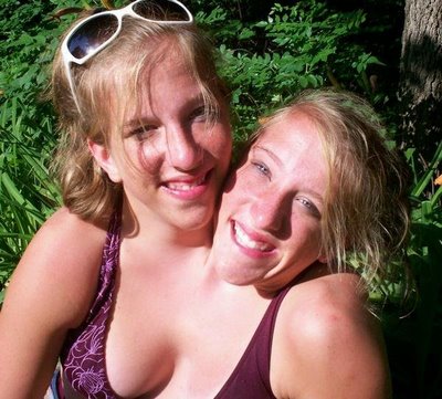 abigail-and-brittany-conjoined-twins