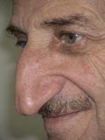 Mehmet Ozyurek-Longest nose in the world