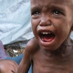 we-should-help-this-little-somalian-child