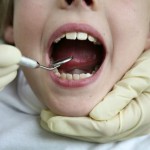 Odontophobia is the fear of teeth
