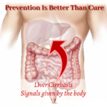 Liver-Cirrhosis-signals-given-by-the-body