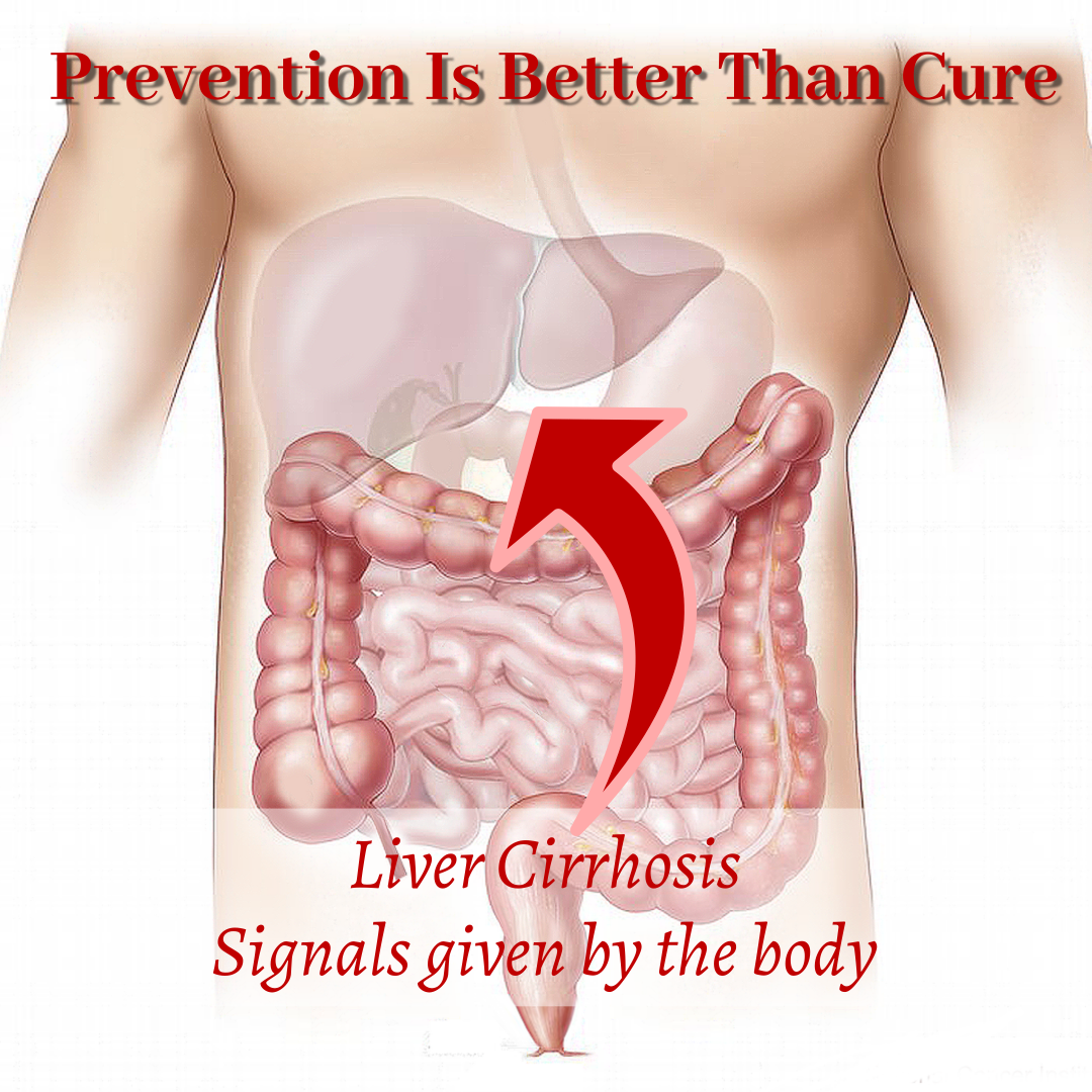 Liver Cirrhosis - signals given by the body 